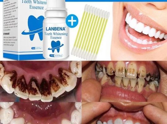 Teeth Whitening Kit – LANBENA 10ml Oral Hygiene And Teeth Whitening